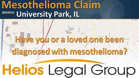 University Park Asbestos Claims And Legal Rights Explained