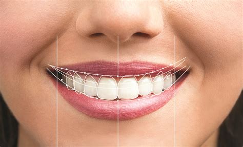 University Smiles Dental: Expert Care For A Perfect Smile